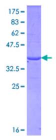 SDS-PAGE (FBN1-3878H).jpg